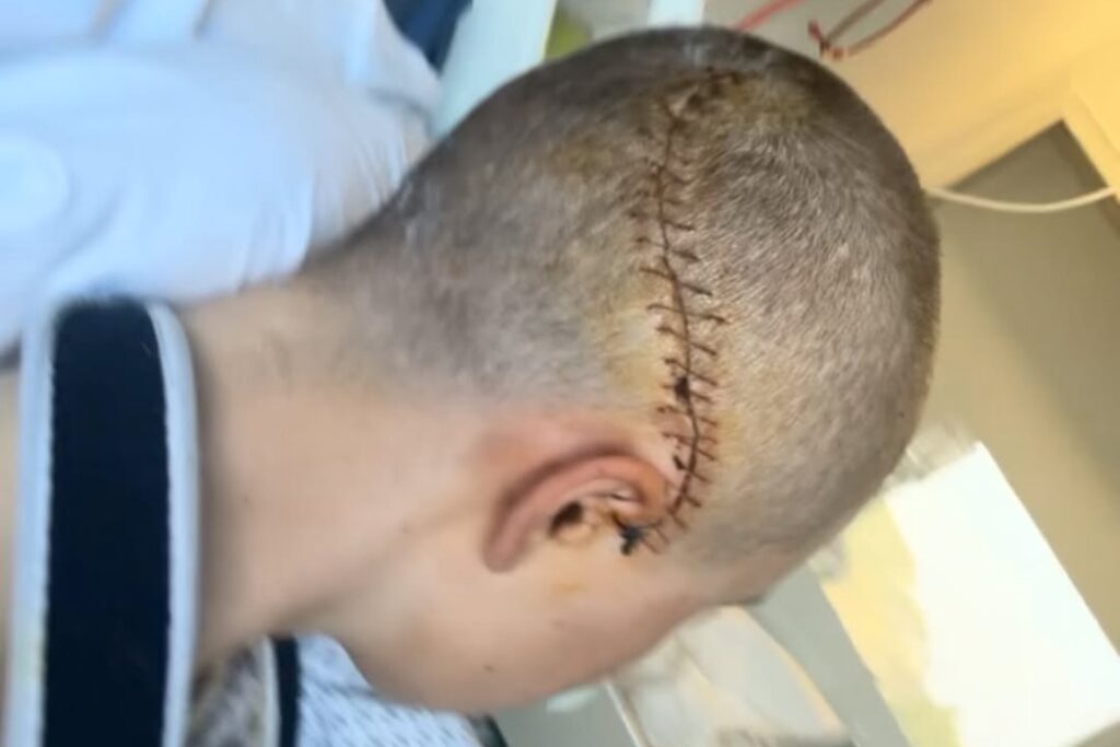 Aasebø accident 2026 - Privat 